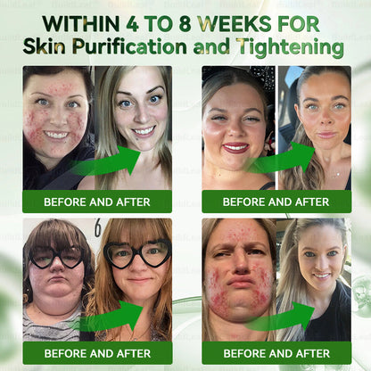 ⏰Congratulations! You have unlocked an exclusive BuildLeaf® offer! i As a thank you for your order, we're offering an additional 30% off today! Click below to grab this special offer, offer expires!⏰